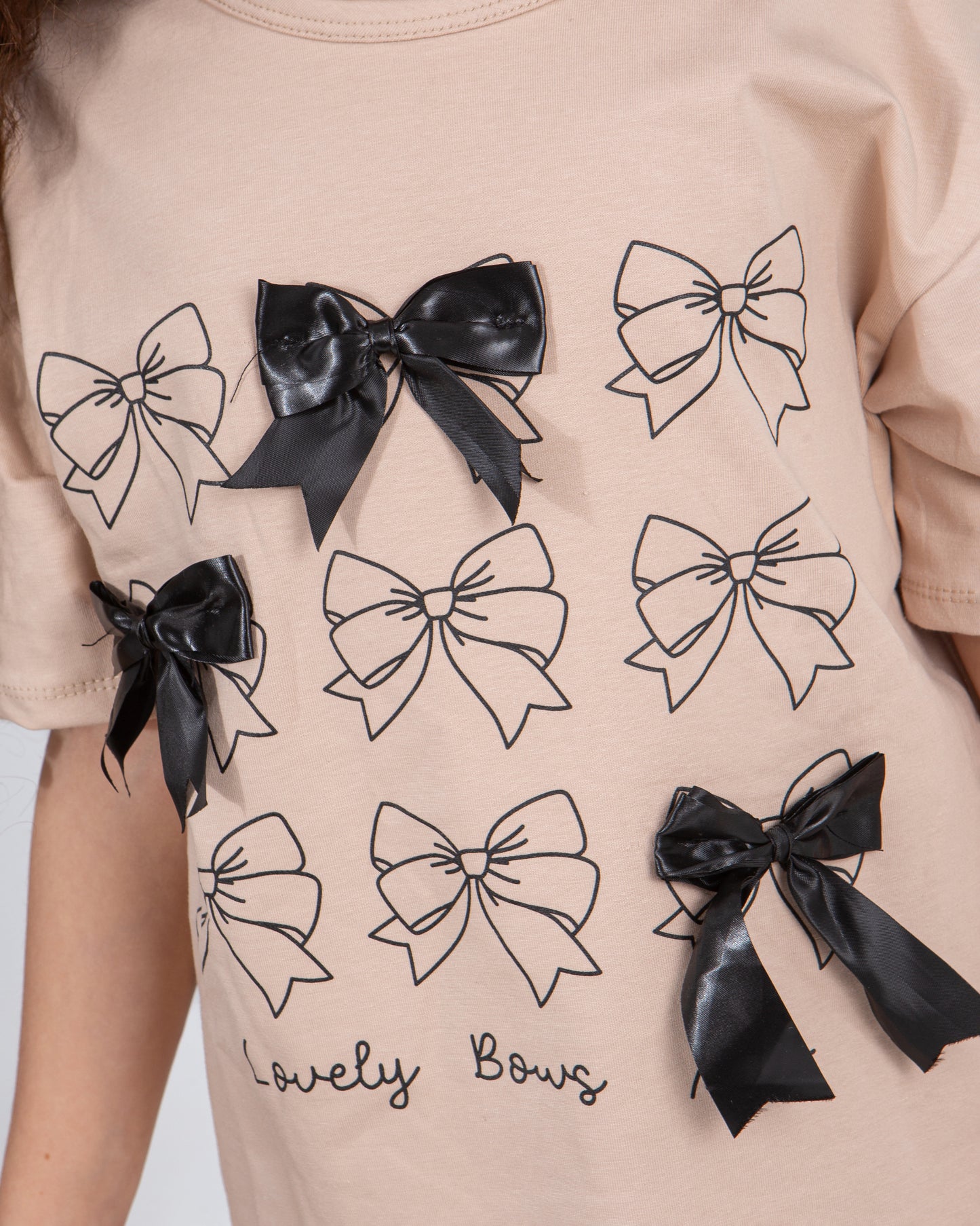Girls’ Summer Set – Bows – 10858